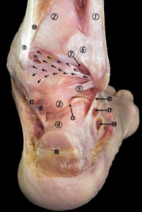 Artroscopia Posterior do Tornozelo com anatomia.