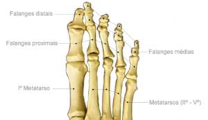 Ossos do pé mostrando o metatarsos e as falanges na Metatarsalgia.
